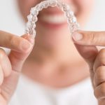 ¿Es mejor el tratamiento de ortodoncia con brackets o invisalign?